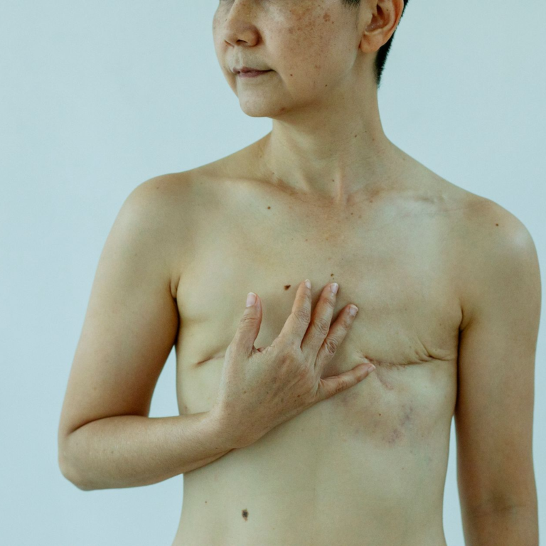 암수술후입원 꿀팁: 수술 준비부터 회복까지 완벽 가이드